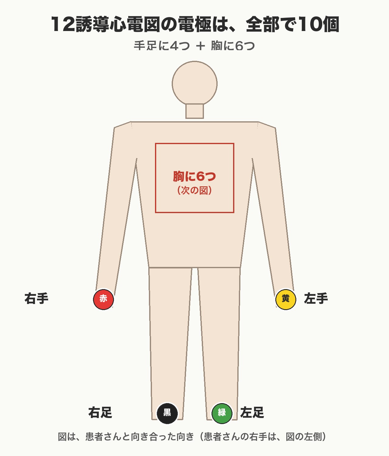 12誘導心電図の手足の電極4つの貼る場所(右手赤・左手黄・左足緑・右足黒)