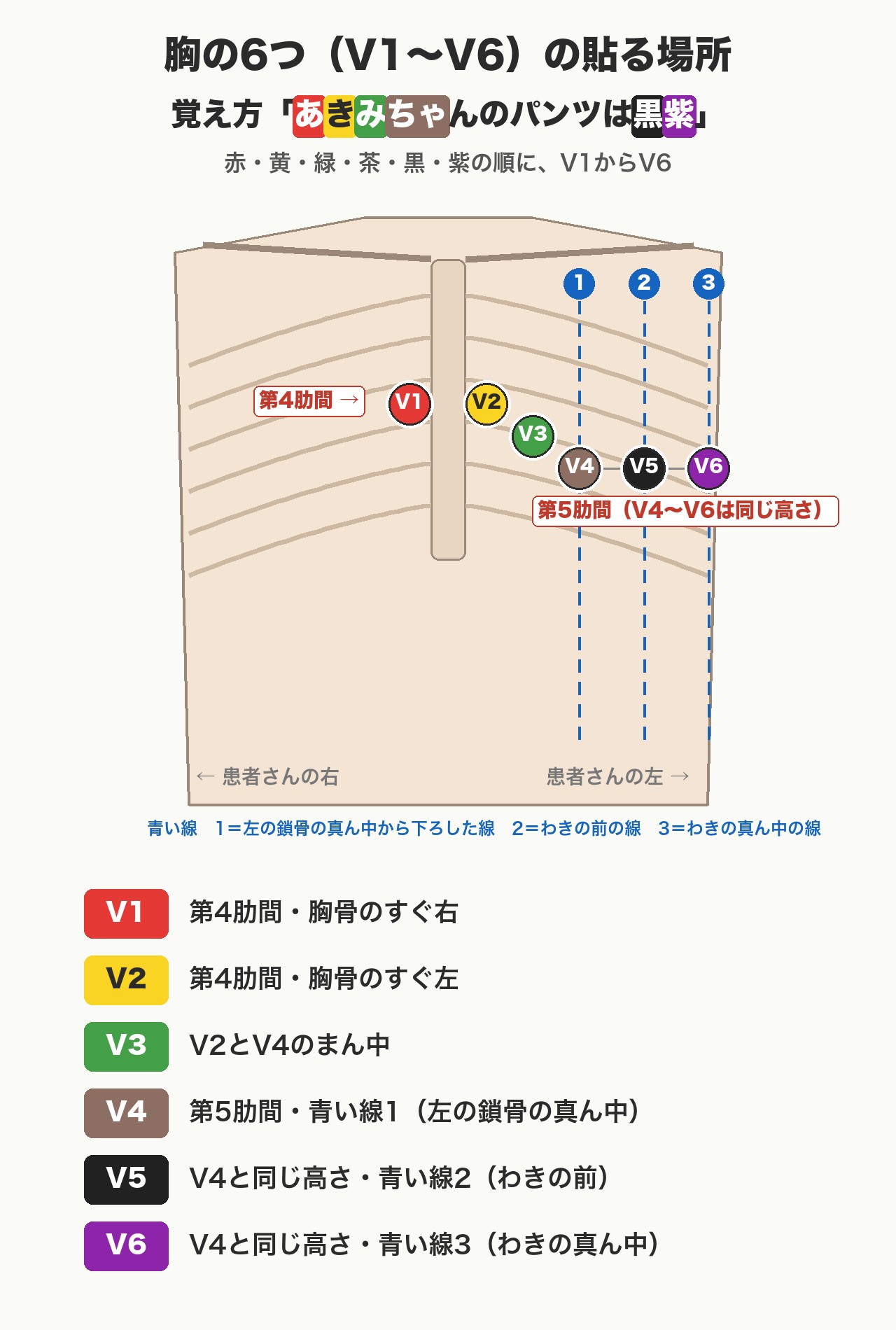 12誘導心電図の胸の電極V1〜V6の貼る場所と覚え方「あきみちゃんのパンツは黒紫」